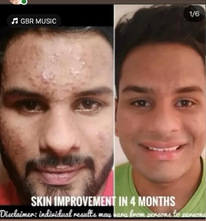 વજન ઘટાડવાની પ્રોડક્ટ વેચવાની છે