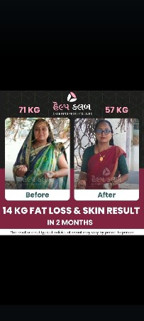 વજન ઘટાડવાની પ્રોડક્ટ વેચવાની છે